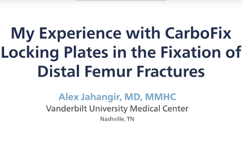 CarboFix Locking Plates