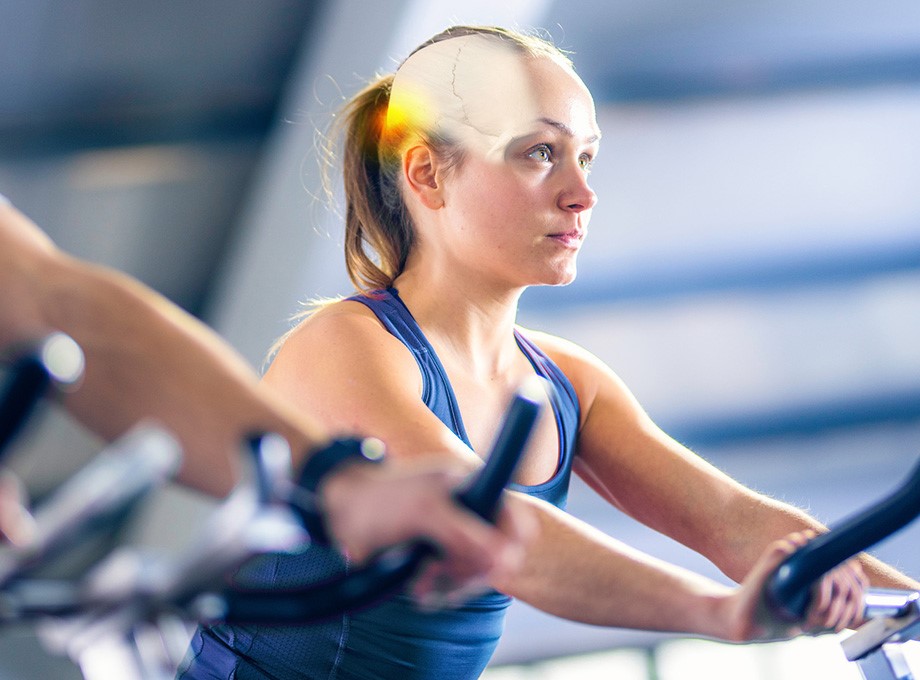 Patient specific CMF implant