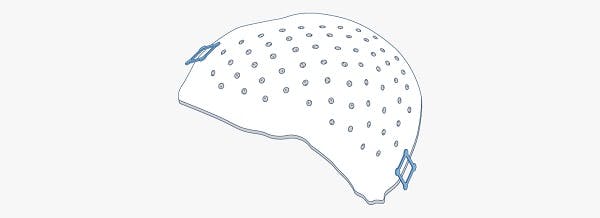 Craniomaxillofacial plates