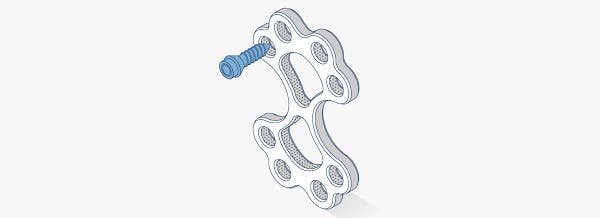 Sternal closure plate