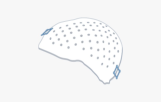 Craniomaxillofacial plates