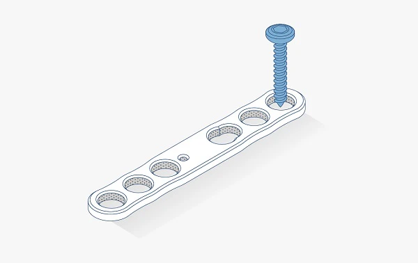 Foot and ankle toe plate