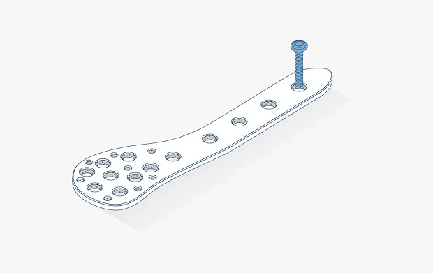 Fracture fixation plates