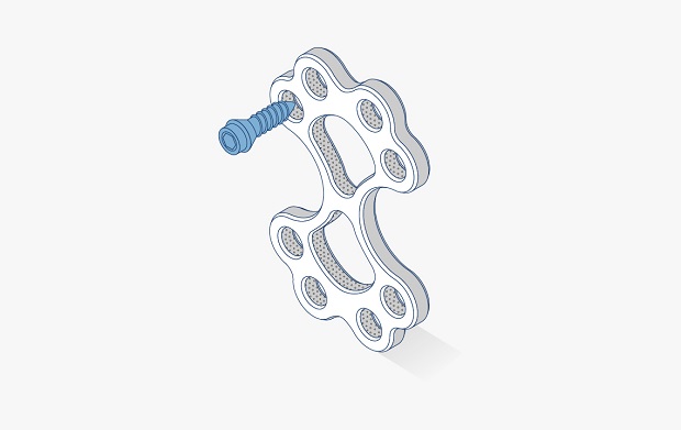 Sternal closure plate