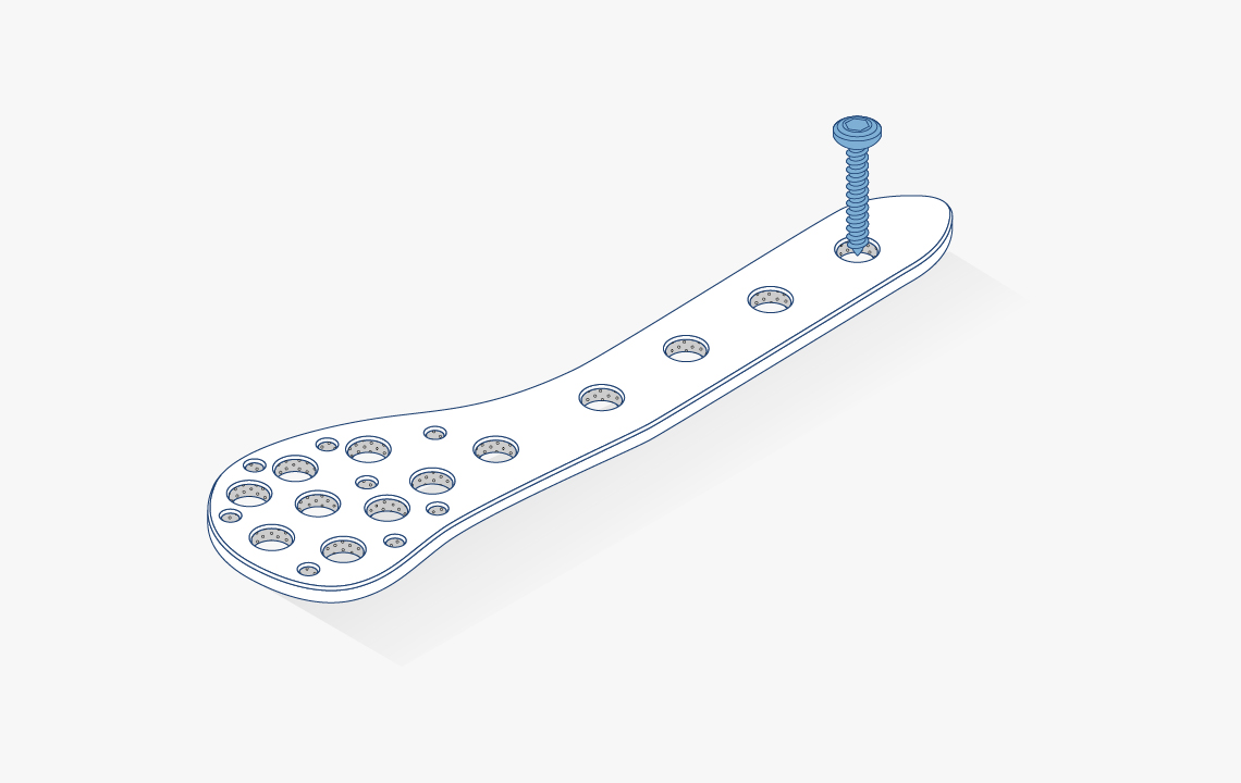 Device Illustrations Fracture fixation plates