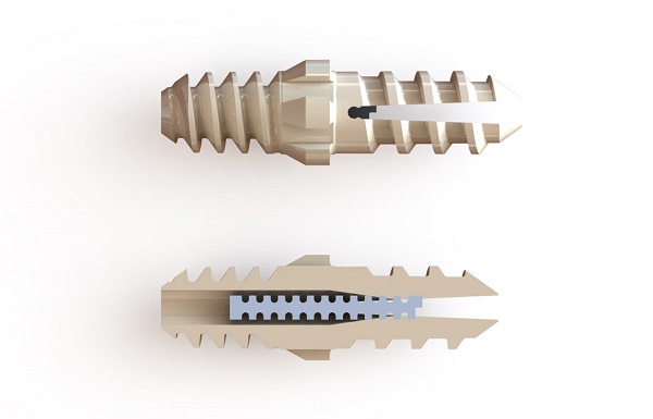 First foot and ankle implant