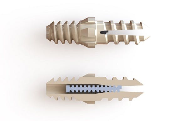 First foot and ankle implant