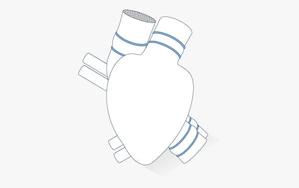 Artificial heart impeller pump