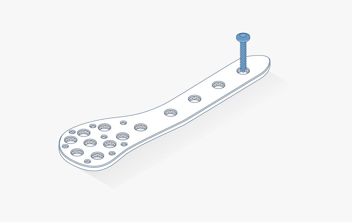 Device Illustrations Fracture fixation plates